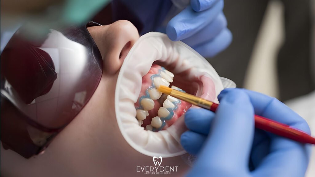 Things to Consider After Teeth Whitening